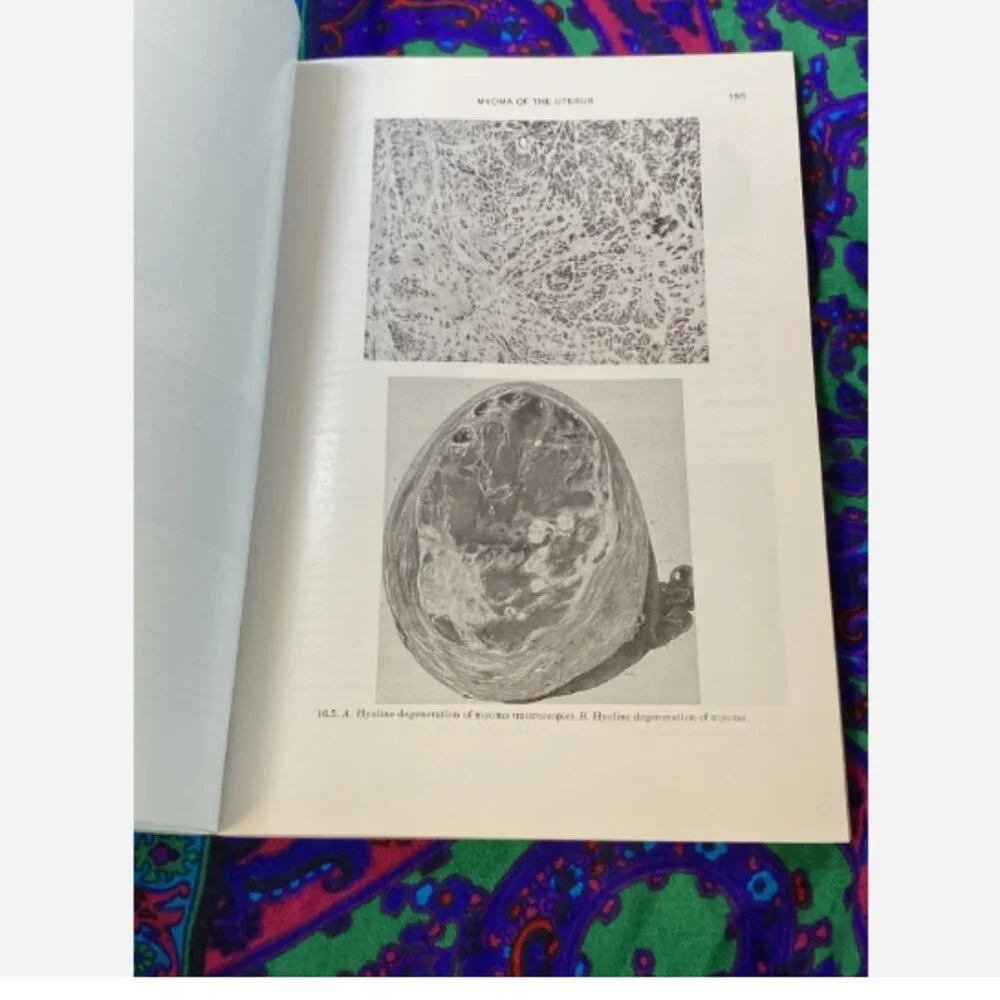 Gynecology Condensed Novak's Textbook Vintage Medical Reference 1975 9th Edition